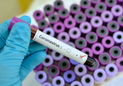 CORONAVIRUS POSITIVE