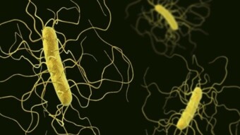 Alzheimer's disease early detection - complete list of tests