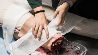Toxic Shock Syndrome Caused leg Amputation in Lauren?