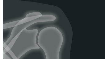 6 tips to get rid of your shoulder complaints