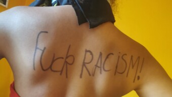 Blackface, Fetishisation, police brutality and the structural pandemic that is racism...