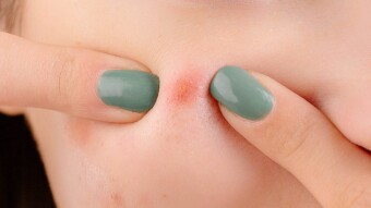 Zits
