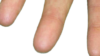 family with no fingerprints