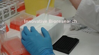 Innovative Bioresearch - The first coin launched by a Biotech company - Airdrex