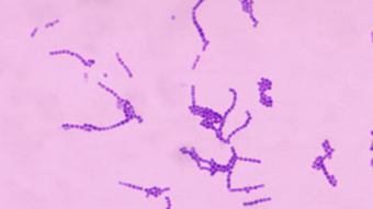 Practical Microbiology: Gram Stains
