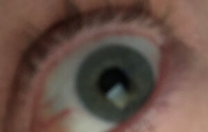 Help! Can my contact lenses make me go blind