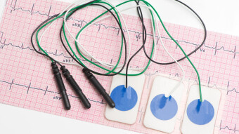 Atrial Fibrillation. Will you Ever Have it?