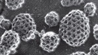 Transporting Stuff in Cell: Vesicles