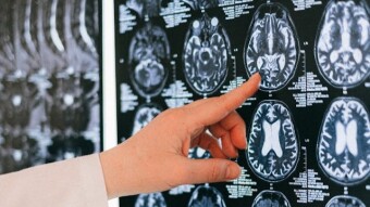 What is Dopamine (And Why Should You Care)?