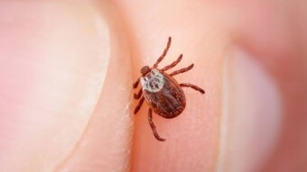 Kissing Bug Bite- Cause of Chagas Disease Throughout Texas