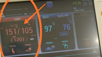 Highblood Pressure and Coffee
