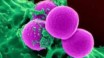 MOVEMENT AND REPRODUCTION IN LIVING ORGANISMS