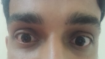 Untold Secret about my Eyes—An Eagle's Vision