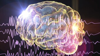 Seizures – A Common Symptoms of a Persons with Epileptic Conditions