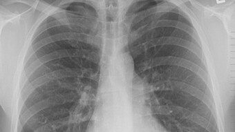 Google Nearly released 100k Health Files Without Consent