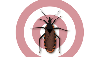 Kissing Bug Bite- Cause of Chagas Disease Throughout Texas