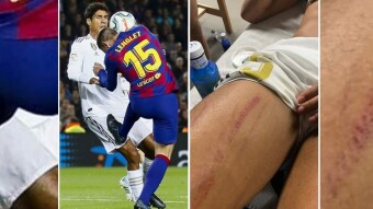 VAR problems again - this time on El Clásico