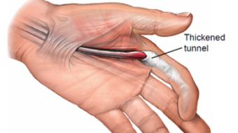What is CryptoRah's Trigger Finger?