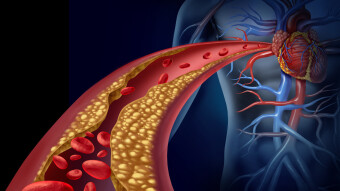 Rh Negative Blood Group May Be Protective Against COVID-19 Infection