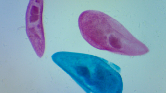 Trying Out My New Microscope - First Attempts and Microscopic Imaging