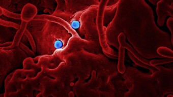 Will Epidemics drive an increase in Veganism?