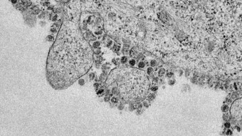 Covid-19 Coronavirus Outbreak: Is the United States Government Covering Up the Spread of the Disease?