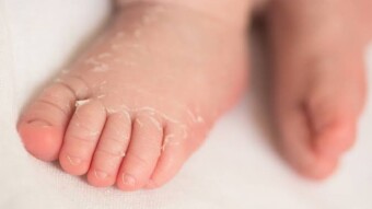 Is Scalded Skin Syndrome Result of Toxins?