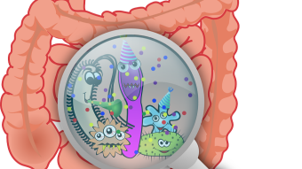 What is irritable bowel syndrome?