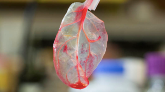 Best Campus Meme - Spinach Heart