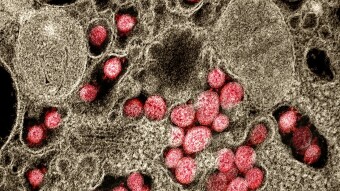 An Update on the Covid-19 Pandemic - Focus on Europe
