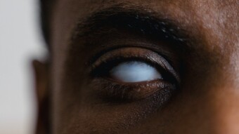 Teleblind