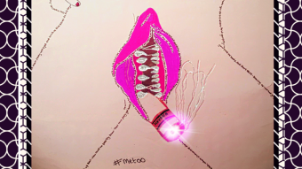 Vagina Dentata