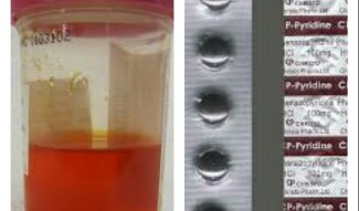 Orange Piss and "The Miracle"