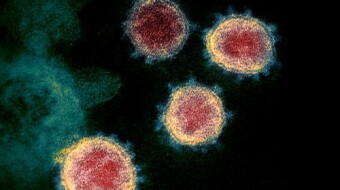 New results on an antiviral that blocks Mers (and which could be useful against the Chinese Coronavirus)