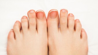 Procrastination: Why do I keep on putting off cutting my toenails off?