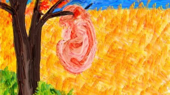 Van Gogh ear