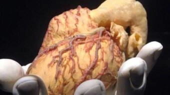 Tips for maintaining a healthy liver
