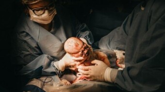 And the baby was delivered...!!
