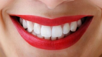 Would you like your teeth to be whiter