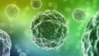 Alzheimer's disease and  what we can do to delay it succesfully