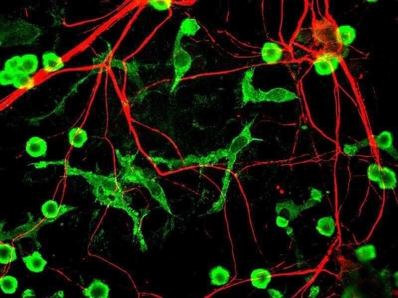 Microglia(green) cells, the immune cells in brain Source Author - GerryShaw CC BY-SA 3.0
