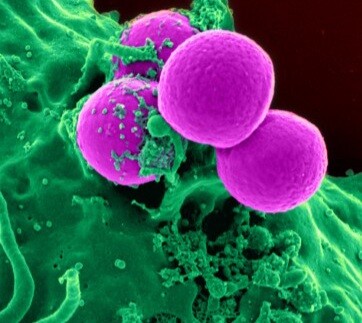 MRSA Bacteria