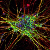 Neuronal