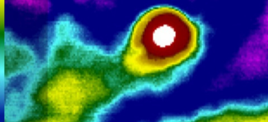 My Psychedelic Infrared World