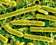 Lactobacillus