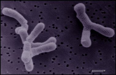 Bifidobacteria
