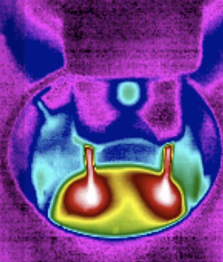 351665157-70c12c3f8189b9a4f68f2bf2f3efeba9a39d55dd351bdc0066606d44d7fbbaa3.png