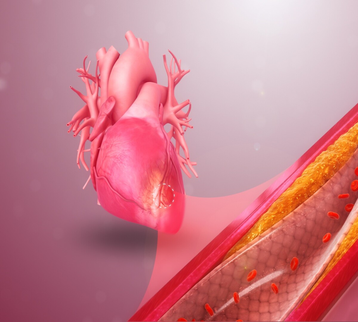 Heart health