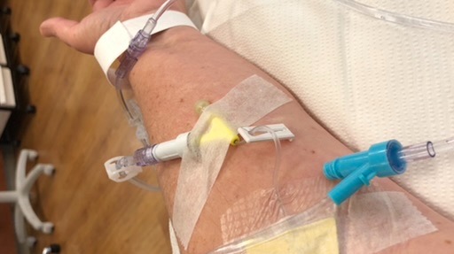 Immunotherapy -Opdivo