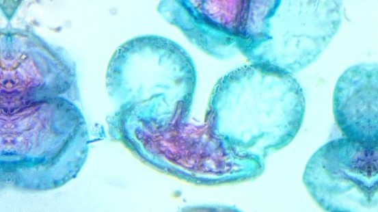 Various plant tissues, including leaves, epidermis, and cones when viewed under a microscope
